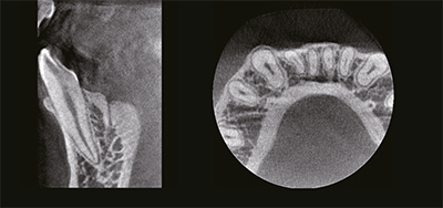 RAYSCAN-Alpha_-160-_1_5.jpg