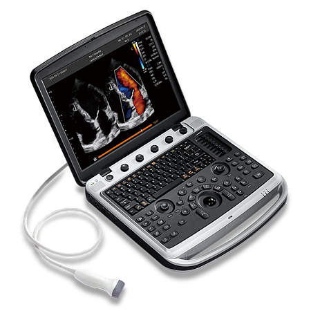 Узи аппарат Chison Sonotouch 80 (SonoBook 9)